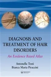 Book cover of Diagnosis and Treatment of Hair Disorders by Antonella Tosti