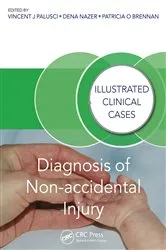 Book cover of Diagnosis of Non-accidental Injury by Unknown