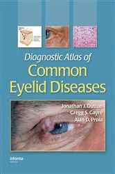 Book cover of Diagnostic Atlas of Common Eyelid Diseases by Jonathan J. Dutton