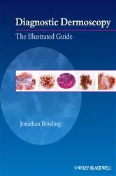 Book cover of Diagnostic Dermoscopy by Jonathan Bowling