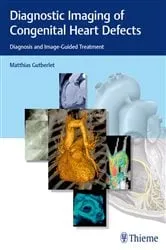 Book cover of Diagnostic Imaging of Congenital Heart Defects by Matthias Gutberlet