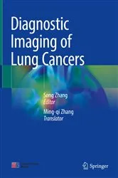 Book cover of Diagnostic Imaging of Lung Cancers by Song Zhang