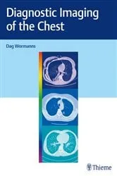 Book cover of Diagnostic Imaging of the Chest by Dag Wormanns