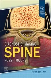 Book cover of Diagnostic Imaging: Spine - E-Book (5th ed.) by Jeffrey S. Ross MD