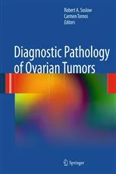 Book cover of Diagnostic Pathology of Ovarian Tumors by Robert A. Soslow