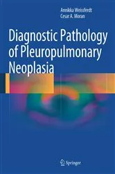 Book cover of Diagnostic Pathology of Pleuropulmonary Neoplasia by Annikka Weissferdt