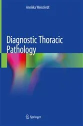 Book cover of Diagnostic Thoracic Pathology by Annikka Weissferdt