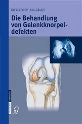 Book cover of Die Behandlung von Gelenkknorpeldefekten by Christoph Erggelet