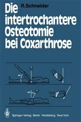 Book cover of Die intertrochantere Osteotomie bei Coxarthrose by R. Schneider