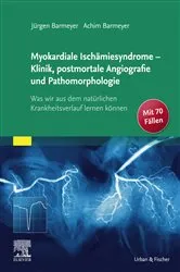 Book cover of Die myokardialen Ischämiesyndrome - Klinik und postmortale Pathomorphologie by Jürgen Barmeyer