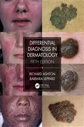 Book cover of Differential Diagnosis in Dermatology (5th ed.) by Unknown