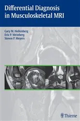 Book cover of Differential Diagnosis in Musculoskeletal MRI by Gary M. Hollenberg