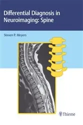 Book cover of Differential Diagnosis in Neuroimaging: Spine by Unknown
