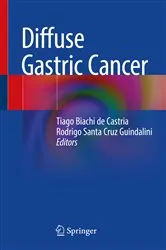 Book cover of Diffuse Gastric Cancer by Tiago Biachi de Castria