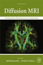 Book cover of Diffusion MRI (2nd ed.) by Unknown