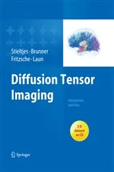Book cover of Diffusion Tensor Imaging by Bram Stieltjes