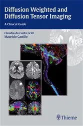 Book cover of Diffusion Weighted and Diffusion Tensor Imaging by Claudia Leite
