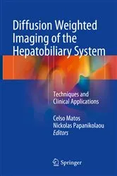 Book cover of Diffusion Weighted Imaging of the Hepatobiliary System by Celso Matos