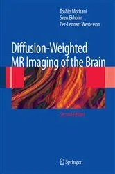 Book cover of Diffusion-Weighted MR Imaging of the Brain (2nd ed.) by Toshio Moritani