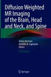 Book cover of Diffusion-Weighted MR Imaging of the Brain, Head and Neck, and Spine (3rd ed.) by Toshio Moritani