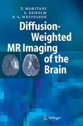 Book cover of Diffusion-Weighted MR Imaging of the Brain by T. Moritani