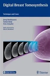 Book cover of Digital Breast Tomosynthesis by Joerg Barkhausen
