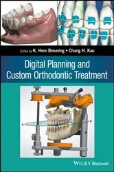 Book cover of Digital Planning and Custom Orthodontic Treatment by K. Hero Breuning