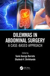Book cover of Dilemmas in Abdominal Surgery by Savio George Alberto da Piedade Barreto