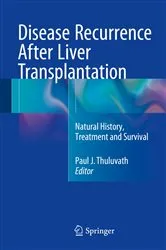 Book cover of Disease Recurrence After Liver Transplantation by Paul J. Thuluvath
