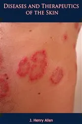 Book cover of Diseases and Therapeutics of the Skin by J. Henry Allen