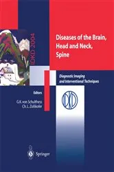 Book cover of Diseases of the Brain, Head and Neck, Spine by Gustav K. Schulthess