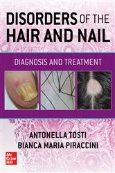 Book cover of Disorders of the Hair and Nail: Diagnosis and Treatment by Antonella Tosti