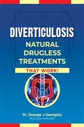 Book cover of Diverticulosis by George John Georgiou