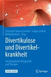 Book cover of Divertikulose und Divertikelkrankheit by Christoph-Thomas Germer