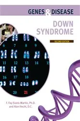 Book cover of Down Syndrome (2nd ed.) by Unknown