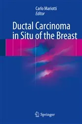 Book cover of Ductal Carcinoma in Situ of the Breast by Carlo Mariotti