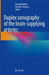 Book cover of Duplex sonography of the brain-supplying arteries by Bernhard Widder