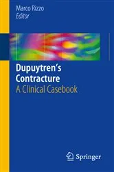 Book cover of Dupuytren’s Contracture by Unknown