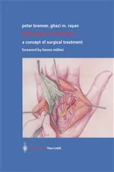 Book cover of Dupuytren’s Disease by Peter Brenner