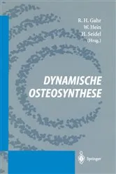 Book cover of Dynamische Osteosynthese by R.H. Gahr
