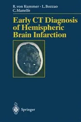 Book cover of Early CT Diagnosis of Hemispheric Brain Infarction by S. Bastianello