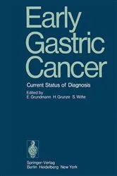Book cover of Early Gastric Cancer by E. Grundmann