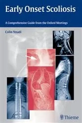 Book cover of Early Onset Scoliosis by Colin Nnadi