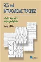 Book cover of ECG and Intracardiac Tracings by George J. Klein