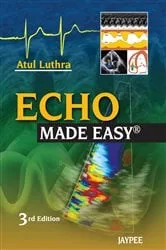 Book cover of Echo Made Easy® (3rd ed.) by Unknown
