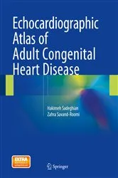 Book cover of Echocardiographic Atlas of Adult Congenital Heart Disease by Hakimeh Sadeghian