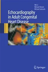 Book cover of Echocardiography in Adult Congenital Heart Disease by Wei Li