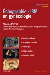 Book cover of Echographie - IRM en gynécologie by Unknown