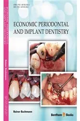 Book cover of Economic Periodontal and Implant Dentistry by Rainer Buchmann