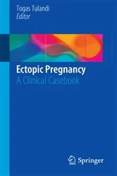 Book cover of Ectopic Pregnancy by Togas Tulandi